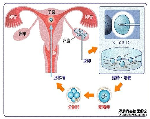 试管婴儿做大概要多少钱？试管婴儿的过程？