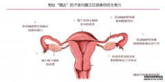 <b>子宫内膜异位症会带来生育力的下降 </b>