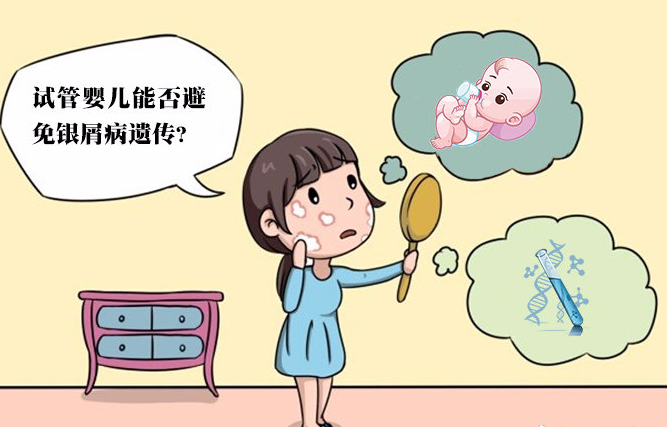 银屑病生孩子风险分析,试管婴儿能否避免银屑病遗传