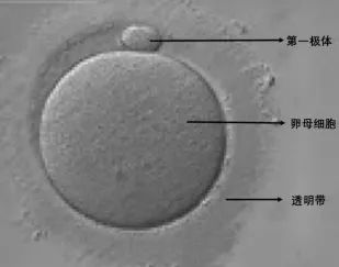 微科普：3分钟教你判断卵子质量等级
