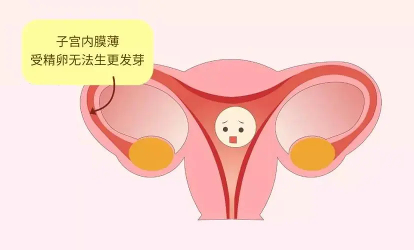 试管备孕前该如何保养子宫？