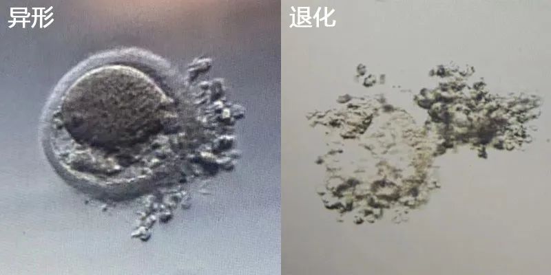 微科普：3分钟教你判断卵子质量等级