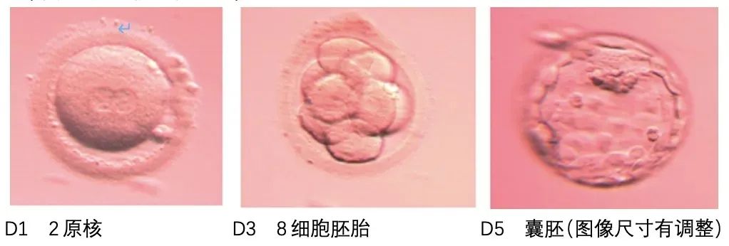 第三代试管（PGT）如何选择胚胎送检？